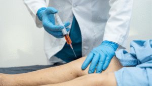 Artificial Synovial Fluid Injection